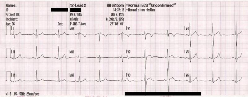Η Σημασία του Ηλεκτροκαρδιογράφηματος στην Καρδιολογία